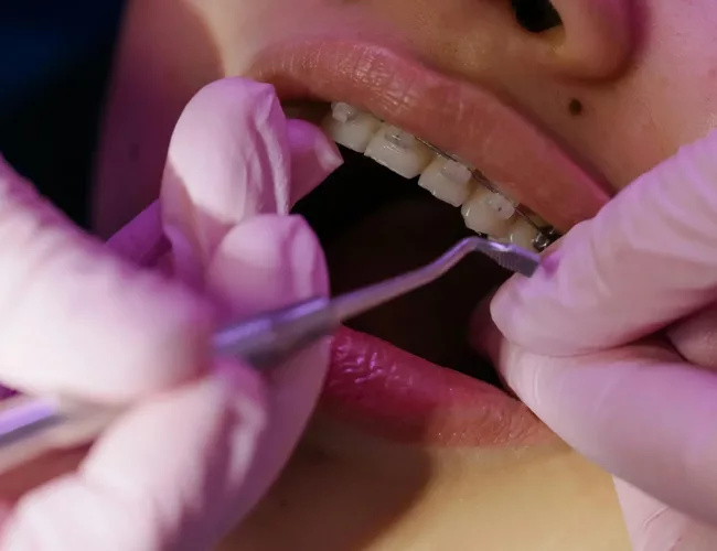 dental_implants_clinic-scaled